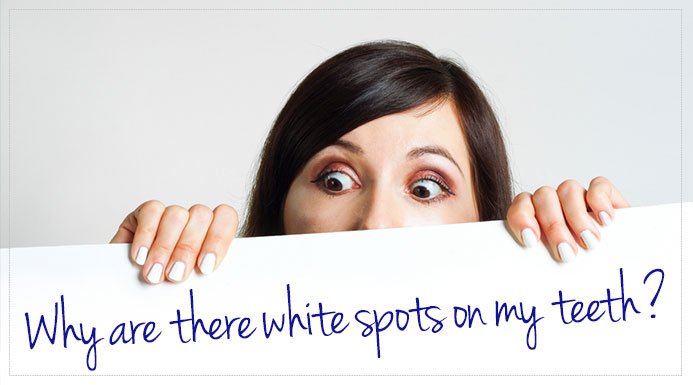 white-spots-on-teeth