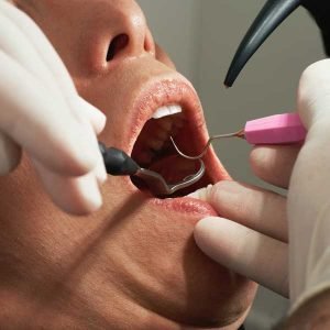 Treatment Options For The Dental Phobic Patient